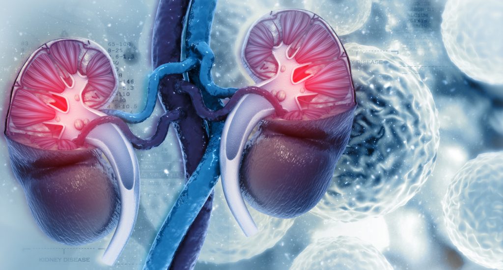 Câncer Renal Ilustração